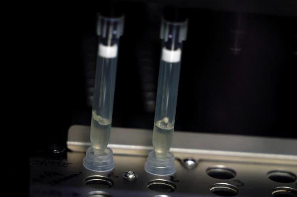 Samples of suspected cases of mo<em></em>nkeypox get tested at a microbiology lab in Madrid