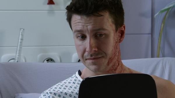 Ryan Co<em></em>nnor sees his scars at the hospital after the acid attack in an episode of Coro<em></em>nation Street